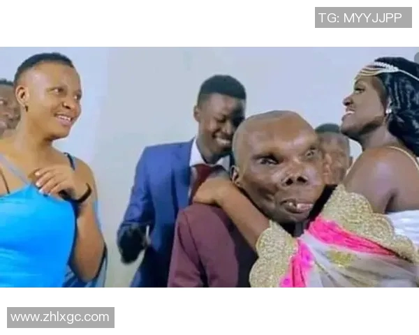 丑陋外表掩盖实力光芒他是足球场上的无畏战士